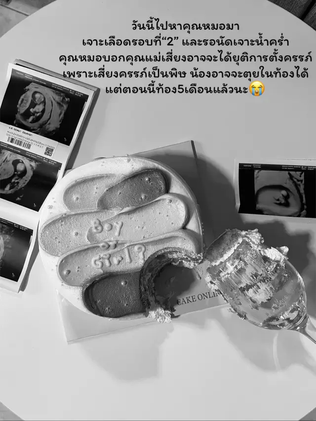 วันนี้ไปหาคุณหมอมา เจาะเลือดรอบที่“2” และรอนัดเจาะน้ำคร่ำ คุณหมอบอกคุณแม่เสี่ยงอาจจะได้ยุติการตั้งครรภ์ เพราะเสี่ยงครรภ์เป็นพิษ น้องอาจจะตุยในท้องได้ แต่ตอนนี้ท้อง5เดือนแล้วนะ🥺 #ยุติการตั้งครรภ์😭 #ครรภ์เป็นพิษ #คุณแม่ตั้งครรภ์  