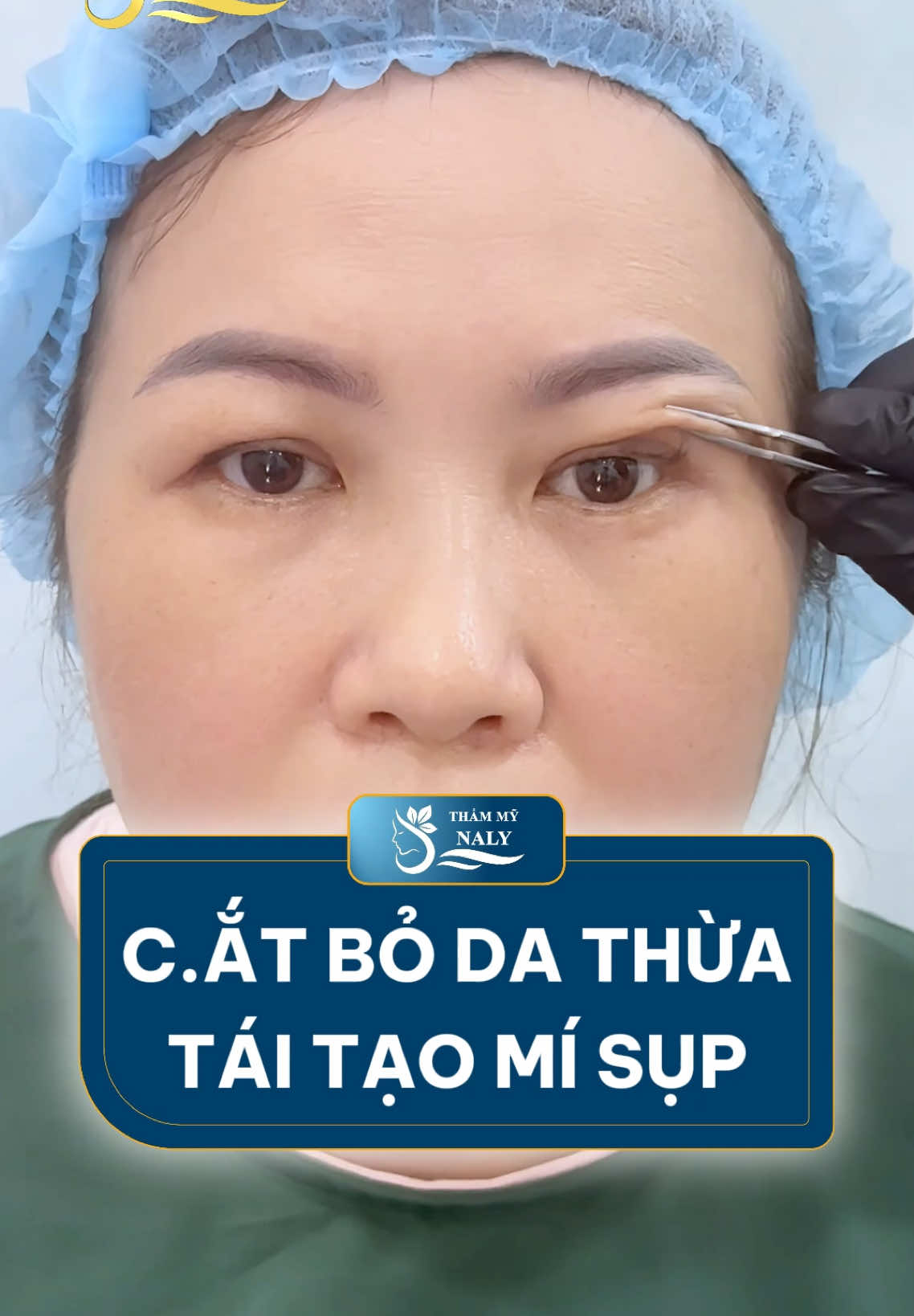 Dừng lại vài giây, xem ngay Trẻ hóá dôi mắt cho cô khách U60 #nangcung #nangcungmay #nangcungchanmay #nangcungchanmayrutchi #goclamdep #xuhuong #thammynaly 