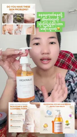 #အရည်ပြားယားနာအမျိုးမျိုးအတွက်ရေချိုးဆပ်ပြာရည်#60103605563အခမဲ့မှာပေးသလိုမှာနည်းလဲပြပေးပါတယ် ##မြင်ပါများပြီးချစ်ကျွမ်းဝင်အောင်လို့😜🤗 #trending #1000k #capcut #tiktokshopmalaysia 