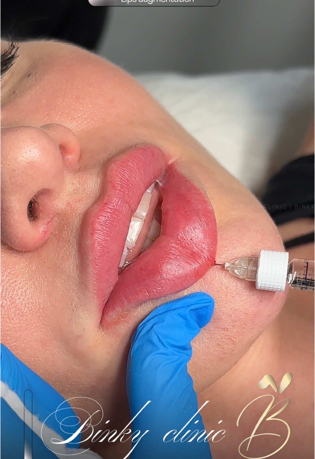 #CapCut #lips #russianlips #russianlipstraining #binkylips #russianlipstechnique #cosmetology #contourlips #londonlips 