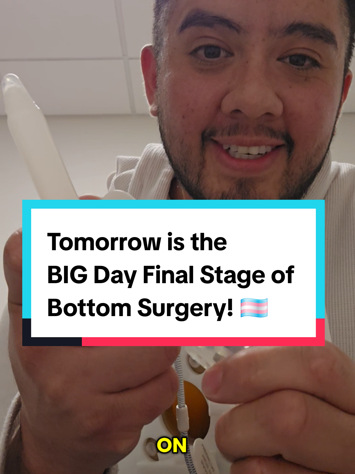 It took 1 year to get to the final stage of bottom surgery, it's a big day tomorrow! #ftm #ftmtransgender #transman #menshealth #lgbt #lgbtq #surgery #bottomsurgery #testosterone #implants #prosthetic #MentalHealth #SelfImprovement #tiktoklearningcapaign 