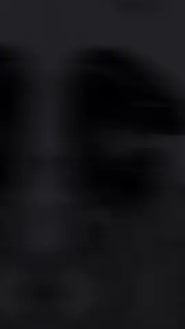 انسانء اكويس بس الاسلاك لاحقتها شمس ..🤕🚶‍♂️