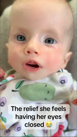 We get told a lot that we should just close her eyes for her, which we do, but we gotta lift up her whole face to make it work. She sure loves it though 🥹 sweet girl #moebiussyndrome #facialparalysis #eyes 