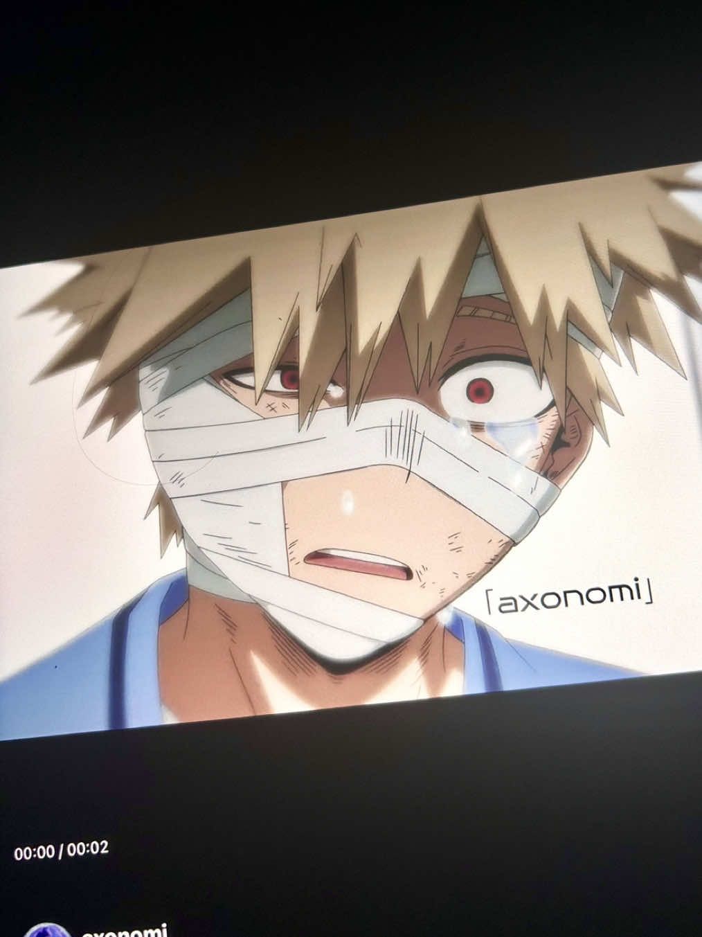 Yêu cái cách em khóc vì Deku  #bakugou #baku #bakugo #bakugoukatsuki #kacchan #dkbk #dkbkcanon #dekubaku #myheroacademia 