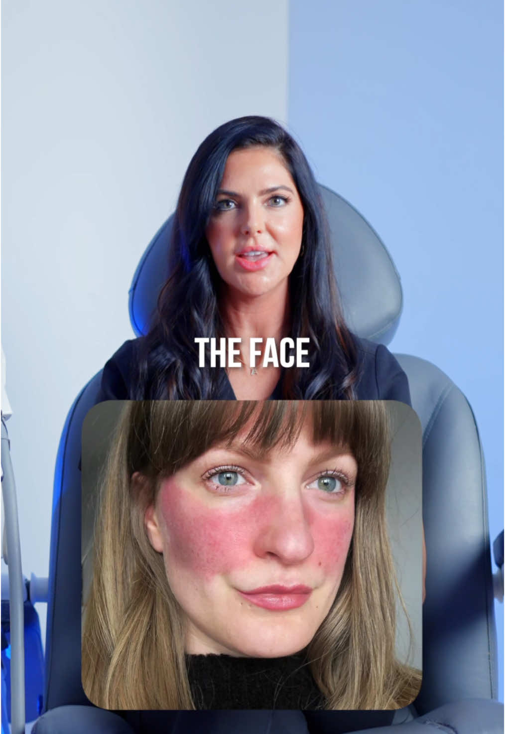 Here’s how we can treat your rosacea! ✨ Credits: @beautyxrenate #renewoklahoma #aesthetics #rosacea #redness #laser #treatment #reaction