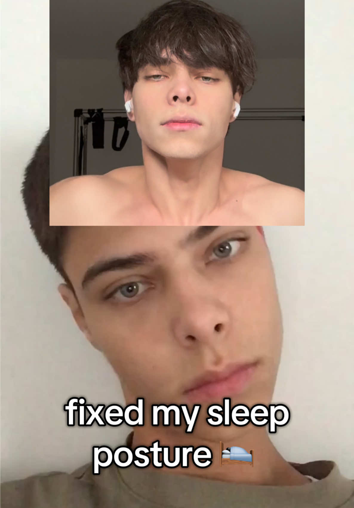 how I actually fixed my asymmetries #looksmaxing #looksmax #glowuptips 
