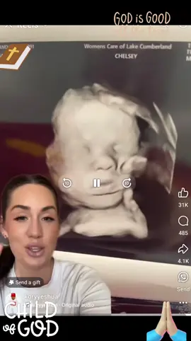 ultrasound of baby with a hand on his head after his mom prays  that God would keep his hand on her baby  at all times