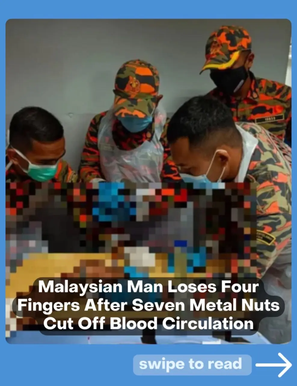 A Malaysian man from Sungai Petani, Kedah, required emergency medical intervention after placing seven metal nuts on his fingers. The 29-year-old sought treatment at Sultan Abdul Halim Hospital on 29 May 2025. His fingers had swollen severely and developed infections because the metal objects restricted blood flow to the affected areas. Hospital staff successfully removed two metal nuts but struggled with the remaining five. They contacted the fire department for assistance at 2:09PM. Amanjaya Fire and Rescue Station chief Azahari Abdullah responded with his team to help extract the stuck objects. Firefighters arrived to find multiple fingers on both hands swollen and infected. They used specialised cutting tools to remove a third metal nut from the man's left middle finger. The extraction operation required approximately 15 minutes to complete. Four fingers had already suffered tissue death from prolonged blood circulation loss. Medical professionals determined amputation was necessary to prevent further complications. The surgical removal aimed to save the patient's life and stop the spread of infection. Authorities continue investigating the circumstances behind the incident. They have not determined why the man placed seven metal nuts on his fingers or how long the objects remained stuck. The motivation and timeline remain under examination. The fire department issued a public safety warning following the incident. They advised against placing metal objects on fingers or other body parts. Such actions can cause serious medical complications including circulation problems and tissue death. #malaysia #amputate #fingers #tiktoksg #fyp 