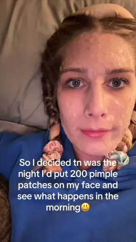 Ummmm…. Idk #fyp #acne #pimplepopper 