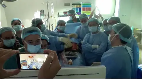 Tự hào nền y học Việt Nam - Giây phút vỡ òa của các bác sĩ, điều dưỡng trong kíp phẫu thuật khi thành công can thiệp dị tật tim bào thai cho sản phụ chuyển từ Singapore sang Việt Nam ❤️ Video: Bệnh Viện Từ Dũ. #benhvientudu #ykhoa #vietnam #sanphukhoa #timbamsinh #bacsi #tuhaovietnam 