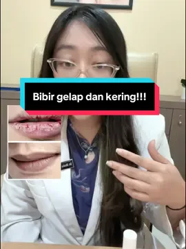 Banyak pria tidak sadar, kesehatan bibir juga penting — apalagi bagi para perokok. Rokok bisa menyebabkan bibir menghitam, kering, bahkan pecah-pecah. Sayangnya, masih banyak yang mengabaikan. Sebagai dokter, aku sarankan perawatan bibir yang bukan hanya melembapkan, tapi juga menutrisi dari dalam. Salah satu yang aku pakai dan rekomendasikan: lip serum ini. Formulanya ringan, gak lengket, bisa bantu cerahkan bibir secara bertahap, dan aman dipakai pria maupun wanita. Cek produknya di keranjang kuning atau langsung lihat ke akun official-nya ya! #perawatanbibir #bibirhitam #bibirgelap #bahayamerokok #thipanklipserum 