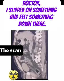 We’ve all been through this kind of emergency 😂😂 #emergency #medical #medicalstudent #hospital #scan #fun #kindersurprise 