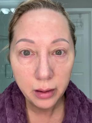 Brighten & Lift Your Eyes Fast! LOVILDS™ Bee Venom Eye Cream – Dark Circles, Be Gone!