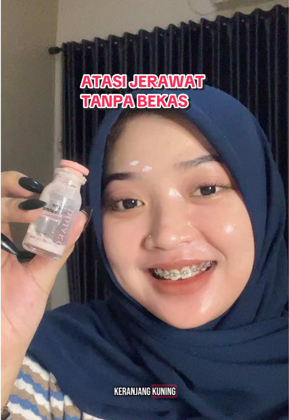 siapa yang disini udah coba? di hari keberapa kalian mulai rasain Jerawat membaik & tuntas? 😍🔥 #fyp #viral #acnetreatment #dojako #dojakoskincare #acnefighter 