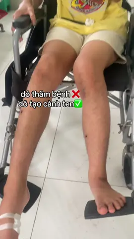 #abcxyz #viral mới khâu cái chân được 3 ngày