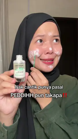 Hari lain selalu elok je, bila time penting macam ni nasib boleh keringkan acne cepat 😫 #skintificdryingotion #ubatjerawatskintific #spottreatment 