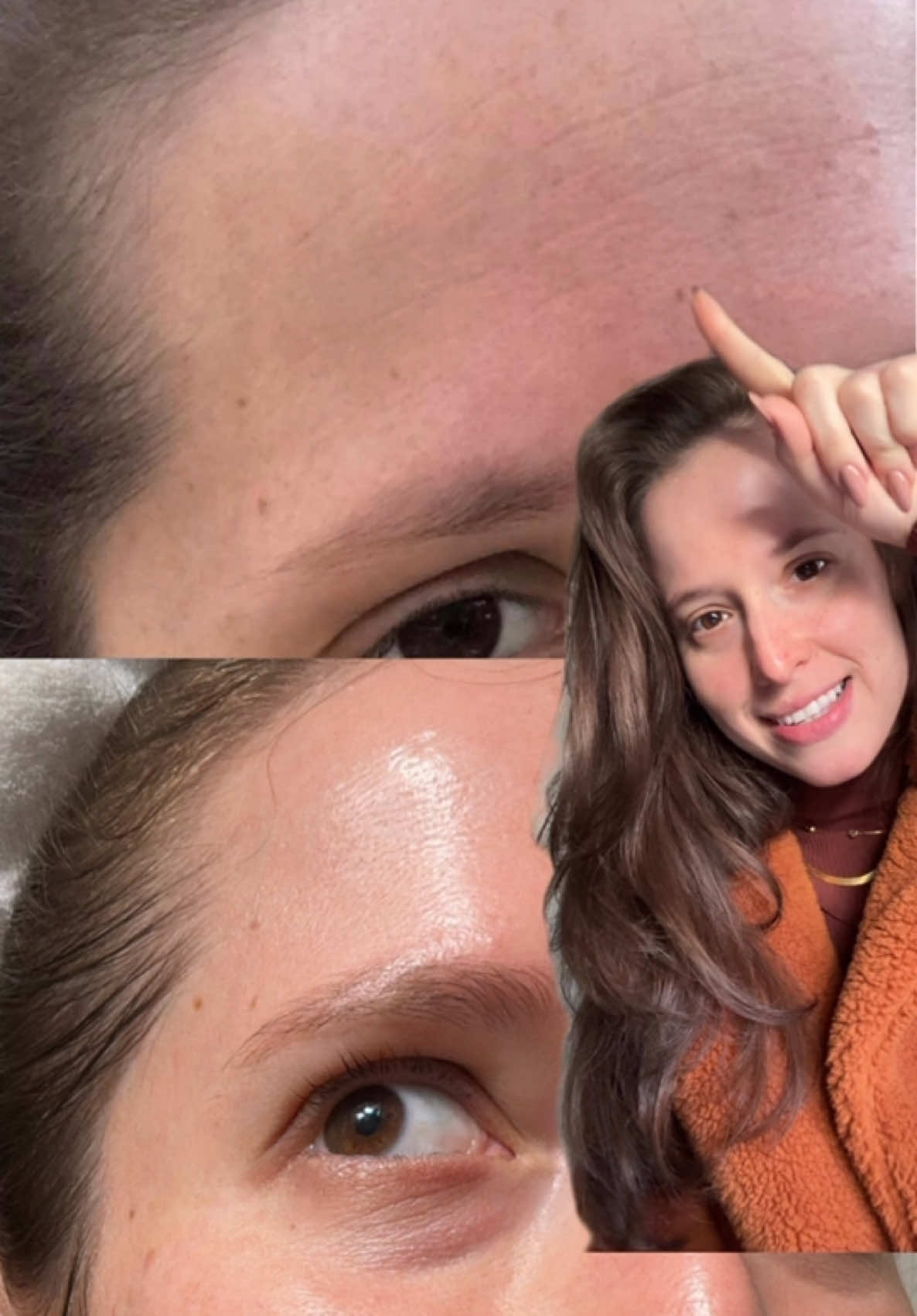 Tudo o que fiz para suavizar as linhas de expressão 🩷 #skincare #skincareroutine #skincarediario #rotinadeskincare #skincarepeleoleosa #skincarediurna #peleoleosa #cosmeticos #peleacneica #trend #viral #skincaretrend  #GlowUp #glowup✨ #explorepage #explorepage✨  #… #…  #sel#SelfCareg#itgirlr#virale#reelsvirala#thatgirlu#aquelagarotat#rotinau#routinei#skincarebrasili#skincareproductso#biorei#skincareskinaquad#hadalaboi#principiaskincarei#skincarediurnot#vitaminact#vitaminacfacialo#protetorsolaro#bioreuvp#duplalimpezau#doublecleansinge#cleansingbalme#cleansingoili#skincareproductsi#skincaretiktokincareviral 