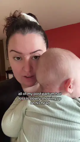 At least someone’s getting hair #baby #babytok #ftm #mom #sahm #momlife #postpartumhairloss 