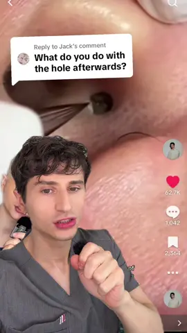 Replying to @Jack What we do with the hole. #dermreacts #skincare #dermatologist #reaction #reactionvideo #dermangelo #pimplepopper 
