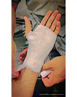 A X C I D E N D🥲❤️‍🩹🥀#foryoupage #fypシ゚ #sad #video #unfrezzmyaccount #dontunderreviewmyvideo #onemillionaudition #300k #viralvideo 