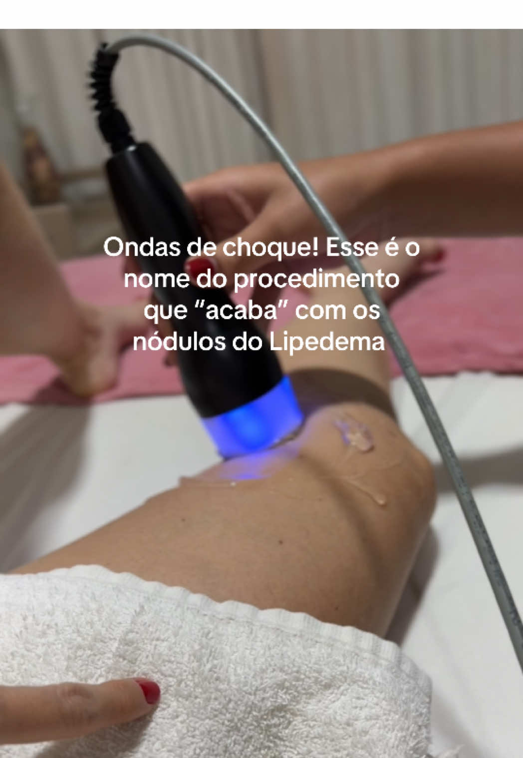 Como acabar com a celulite?! Dieta, treino e estética. Esse é o segredo e no Lipedema melhora absurdamente muito!!! Vc já fez? Conta…  #lipedema 