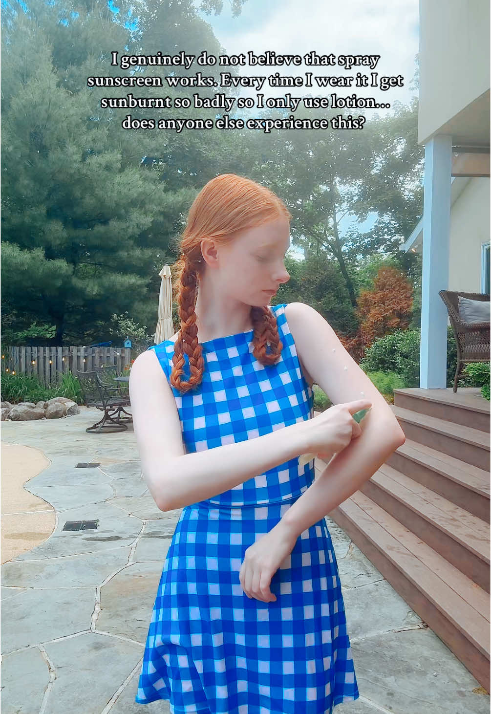 Or am I just that pale lol? #pale#paleskin#Summer#tanning#tan#fyp#sunscreen 