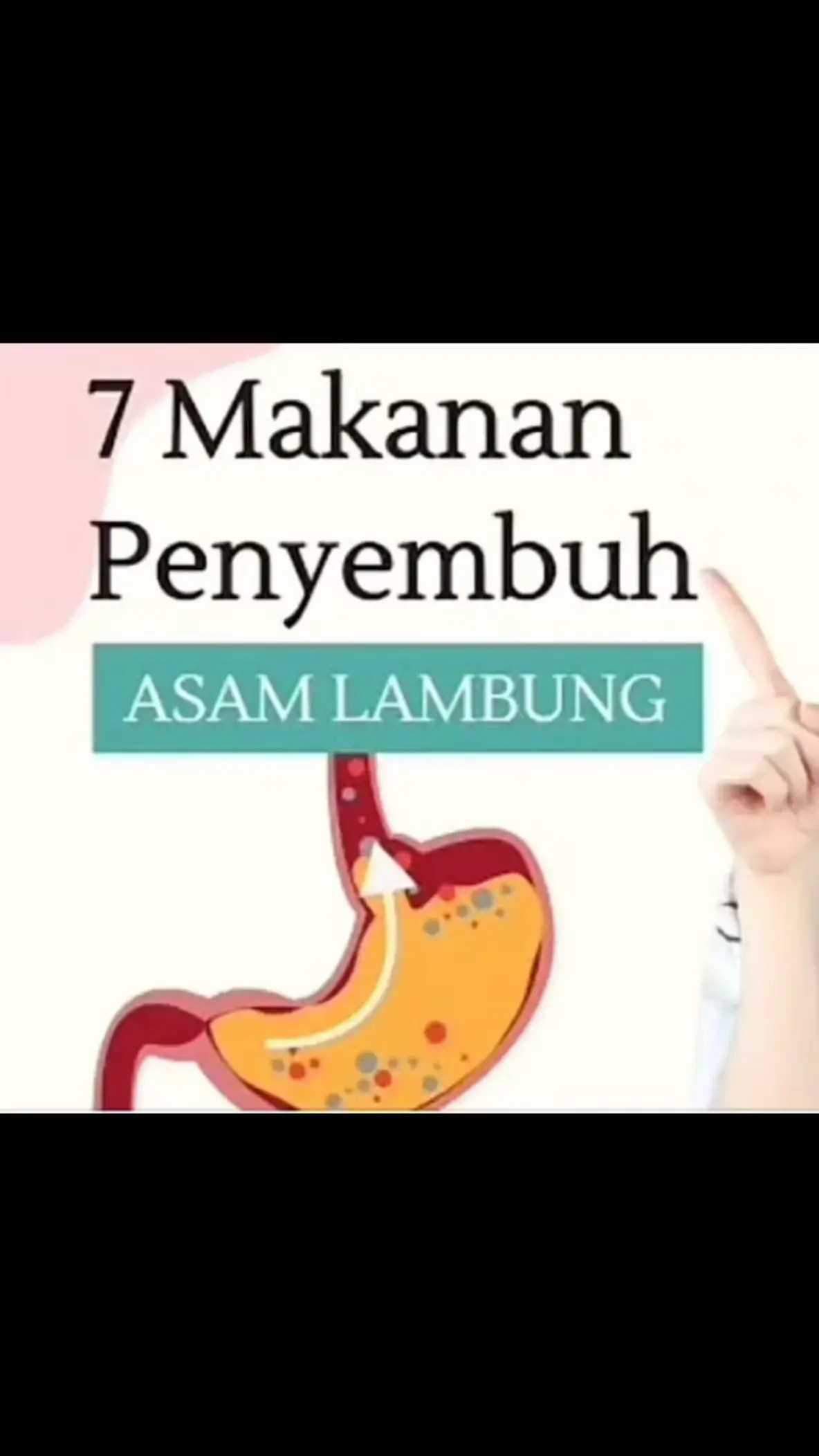 #lambungsehatbireuen #drsafrizaljufri #viral #fyp 