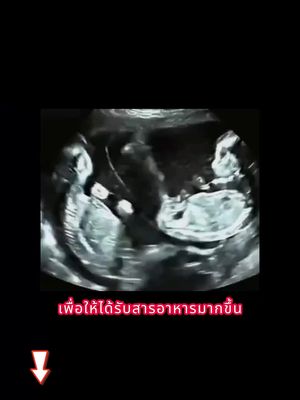 ดูละครสั้นยอดนิยมออนไลน์ฟรี มาดู