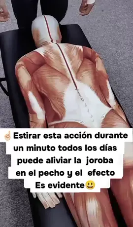 ✨Aliviar la Joroba: Consejos y Ejercicios para Mejorar la Postura y Reducir el Dolor La joroba, también conocida como cifosis, puede ser causada por una variedad de factores, incluyendo la mala postura, el envejecimiento y ciertas condiciones médicas. A continuación, te presento algunos consejos y ejercicios que pueden ayudarte a aliviar la joroba y mejorar tu postura. *Consejos* 1. *Mejora tu postura*: Mantén la espalda recta y los hombros relajados. Evita encorvarte o inclinarte hacia adelante. 2. *Fortalece los músculos de la espalda*: Realiza ejercicios que fortalezcan los músculos de la espalda, como extensiones de espalda y ejercicios de estabilización. 3. *Estira los músculos del pecho*: Realiza estiramientos que ayuden a relajar los músculos del pecho y mejorar la postura. *Ejercicios* 1. *Estiramiento de pecho*: Coloca tus manos en una pared o puerta y estira el pecho hacia adelante. 2. *Extensión de espalda*: Acuéstate boca abajo y levanta los brazos y las piernas hacia arriba. 3. *Ejercicio de estabilización*: Colócate en posición de plancha y mantén la espalda recta durante 30 segundos. #curatucuerpo #Beneficios #saludybienestar #lasmejorestecnicas #masajesterapéuticos #LATAM #masajesrelajantes #enelmundoentero♥️ 