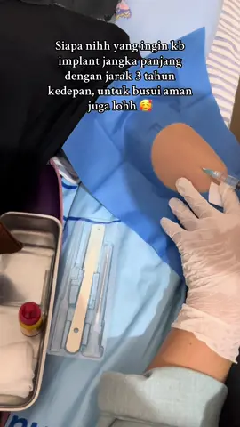 CARA KERJA KB IMPLAN? KB Implan (Susuk KB) adalah salah satu jenis kontrasepsi yang berupa batang kecil fleksibel. Proses pemasangannya dengan cara memasukan batang fleksibel ini ke bawah kulit bagian lengan atas. Setelah terpasang, nantinya alat ini akan melepaskan hormon progestin ke dalam aliran darah untuk mencegah kehamilan. Hormon tersebut mampu mencegah ovarium untuk melepaskan sel telur (ovulasi). #bidanindonesia #kbimplant #tenagakesehatan 