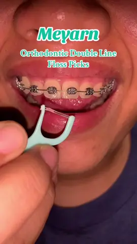 Nako mag floss kana.#meyarn #meyarnfloss #meyarnorthodonticfloss #meyarnorthodonticdoublelinefloss #meyarndentalfloss 