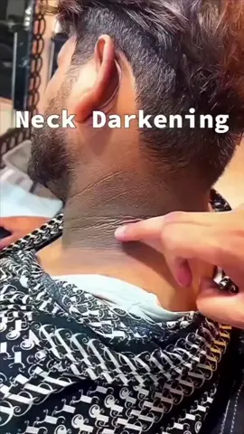Remove Neck Darkness & Tanning At Home Easy  . . . #neckcleaningtips #darkneck #neckdarknessremoval #skincare #treandingtiktok #tiktokviral #tiktok 