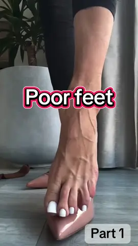 After 8 hours in heels… my feet are red, sore, and full of veins 😩 #HeelsProblem   #FootPainRelief   #VeinCare   #TiredFeet   #SelfCareHack   #BeautyHurts   #FootMassage   #TikTokFinds   #TikTokMadeMeTryIt   #BeforeAndAfter   #FootCareTips   #SoreFeetFix