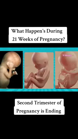 What's happens during 21 weeks of pregnancy? #21WeeksPregnant #FetalDevelopment #PregnancyMilestones #BabyBump #SecondTrimester #SecondTrimesterEnding #PregnancySymptoms #FetalMovement #Maternity #PregnancyJourney #PregnancyHealth #FetalGrowth #PrenatalCare #MomToBe #BabyOnBoard #PregnancyLife #FetalDevelopmentStages #PregnancyWeekByWeek #PregnancyTips #HealthyPregnancy #HalfwayToMeetingBaby #ThirdTrimesterAhead #pregnancyprogress 
