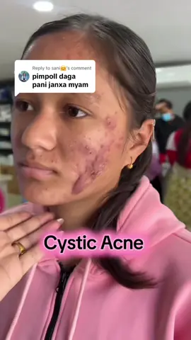 Replying to @sani🤗 #muser #stretchmarks #foryoupage #burnt #scar #musergeneretion #musicas #scarstoyourbeautiul 