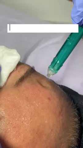 Tindakan Natasha Botanical Jet Peel Perawatan kulit menggunakan serum botanical anti-aging dan tekanan tinggi oksigen dengan kecepatan aliran 200m/detik. Kulit menjadi lebih sehat, segar bersih, kenyal dan bersinar yuk reservasi sekarang🥰