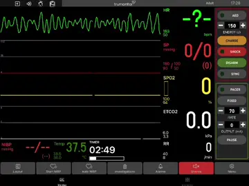 Arkadaşle artık ekg üstüne senaryolu bir içerik üretmeye karar verdim buda ilk vakamız olsun 74 yaşında erkek hasta aniden yere yığılıyor olay yerine gittiğimizde bilinç kapalı nabız yok monitöre bağladığımızda ritim bu şekilde ritim nedir ve nasıl bir müdahale etmeliyiz? • • #paramedik#paramedic#emt #ekg #keşfetteyizzz #paramediclife #paramedicstudent #112acil 