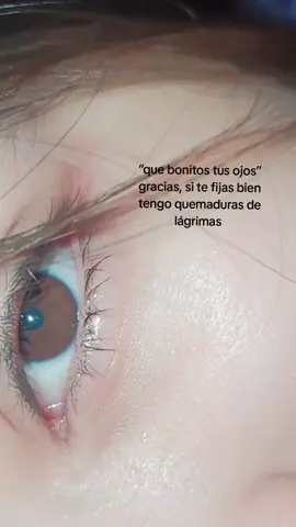 #ojos#quemadura #girl #niñas #xzyabc #mujeres 
