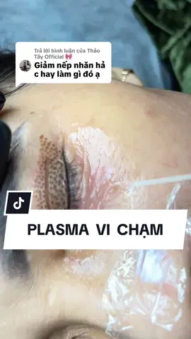 Trả lời @Thảo Tây Official 🎀  Xóa nhăn + rút mô mô với ky thuật Vi Chạm Plasma . d.l eê …  l.hệ   :  o9o6 .. ba...1..1….6..ba...8 ( Ngân ) #mực#mựclabinao#kyoungspayo#kyoungacademys#lasermayla#Plasma_KoreaFus#Fusion_plasmap#Hyper_plasmaol#Coldplasmaa#Plasmalanhas#lasernámp#Prpi#phiu_lờa#SpaMes#Meso_cân_chỉnhes#Meso_trẻ_hoáes#meso_trǎng_sáng_nho_lcli#vairalh#xuhuonghu#Chuyên_phunxăm_màymoihu#Chuyen_trị_seorổs#laser_mày_môi_míc#Mực_Labina_xáchtaytrựctiếpoá#Xoá_mực_míoa#xoamioamaydu 