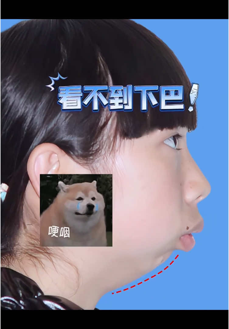 Always ridiculed as a chubby fish, watch me flip two levels # Nose # Nose synthesis # Rib nose # Rib nose synthesis