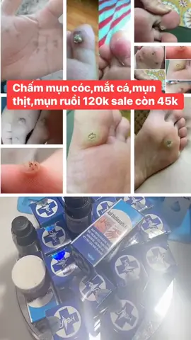 #Lọ_chấm_mụn_cóc_mắt_cá_45k 