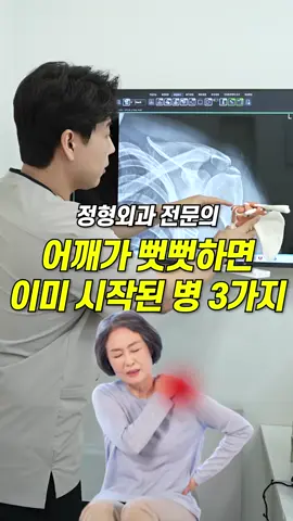 어깨가 뻣뻣하다면…이미 시작된 병, 3가지😰 요즘 어깨가 잘 안 올라가고, 무거운 느낌이 계속되시나요? 단순한 피로가 아닐 수 있습니다. 이미 어깨 질환이 시작됐다는 경고일 수도 있거든요. 특히 뻣뻣함 + 통증이 함께 있다면 절대 그냥 넘기지 마세요. 초기 진단만 잘 받아도 수술 없이 충분히 좋아질 수 있습니다. 정형외과 전문의가 알려드리는 어깨 질환의 초기 증상! 🎥지금 영상에서 꼭 확인해보세요 :) #오십견 #회전근개파열 #어깨통증 #어깨아플때운동 #어깨아픈증상 #오십견증상 #오십견치료