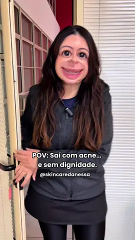 Nem as minhas acnes esperavam por isso 🤌🏼😮‍💨 #acne #fy #skincare 