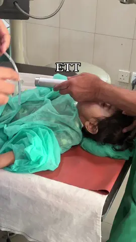 Patient under general anaesthesia with ETT #anesthesia #hospitallife #generalanesthesia #doctor #anesthesiologist #opertiontheatersound #eyesurgery #operation #lifesaver #fyp #foryoupage❤️❤️ #illu #hospitallife🤗🤗 #viral #generalanesthesiaproced #foruyou #forupage 