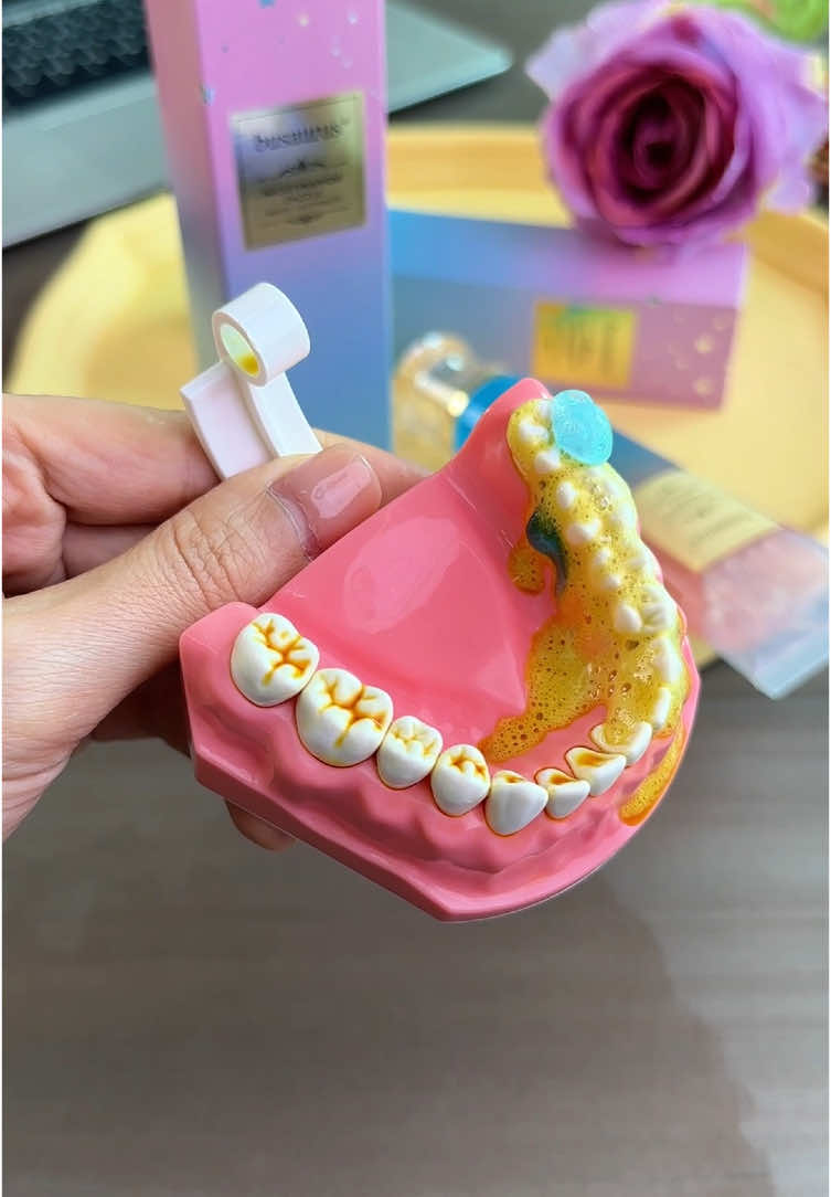 Clean your teeth. problems. #uktiktok #tiktok #teeth #clean #tooth #toothpaste #cavities #healthy #oral #springtok #bodyaccel