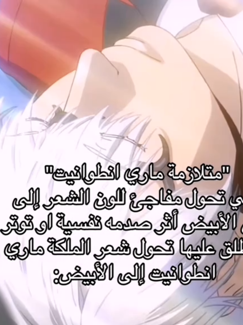 متلازمه غريبه #ماري_انطوانيت #fyp #viral #اكسبلور #لانا_منطقيه #marieantoinette 