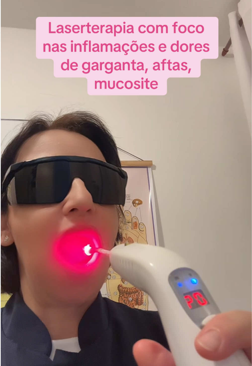 Laserterapia na mucosa oral para tratamento de garganta, mucosite, aftas . Quer saber como a Laserterapia pode ajudar? Pergunte, comente.        #laseterapia               #saudeebemestar             #inflamações.              #mucosite.                              #dor.                                           #feixedeluz #lesao #PioresSituaçõesSemArCondicionado 
