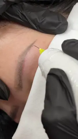Vấn đề này có nhiều người gặp phải nè!  nhưng sau khi làm plasma xong không biết dùng loại nào trị tăng sắc tố thì mọi người sẽ dùng loại ở giỏ hàng của em gắn nha! 