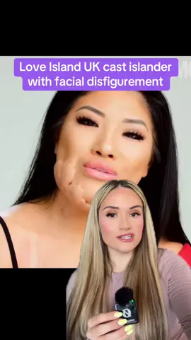 Love Island UK cast islander with facial disfigurement #loveoslanduk #loveislanduk #LoveIsland #tv #tvseries #itv #sophielee #fyp