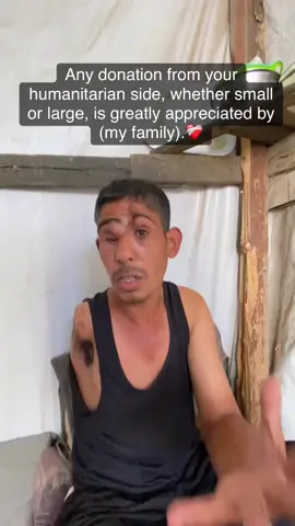 This man (Hilal) lost his entire hand and lost his eye and can no longer see with it in the events of Gaza, and he is the head of a family who is not able to work to provide the basics of living and cannot provide treatment for himself, do not forget that he also has a whole family and children, how should he feed them, what is their life like without care, without food, without clothes and nothing, please do not forget them from your generous giving, support their campaign and do not leave them, their lives are on (our shoulders) understand well, the link to help is in the biography. Thank you for your kindness and understanding (of humanity)❤️‍🩹🖤 هذا الرجل هلال فقد يده بالكامل وفقد عينه ولم يعد يرى بها في أحداث غزة وهو رب أسرة لست قادر على العمل لتوفير أساسيات المعيشة  ولايمكنه توفير العلاج لنفسه لاتنسوا أيضاً لديه عائلة كاملة وأطفال  كيف عليه إطعامهم كيف تبدو حياتهم بلا رعاية وبلا طعام وبلا ملابس وبلا شيئ من فضلكم لاتنسوهم من عطاؤكم الكريم ادعموا حملتهم ولاتتركوهم ،حياتهم باتت على (عاتقنا)تفهموا جيداً  ❤️‍🩹🖤شكراً لجانبكم وتفهمكم (للإنسانية) #fuy #followers #food #followforfollowback #fypシ #followforfollowback